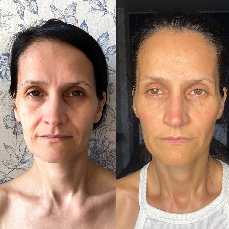 Елена, 47 лет — результат авторского массажа лица, до и после